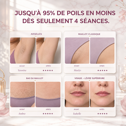 Sovelya • IPL PULSE