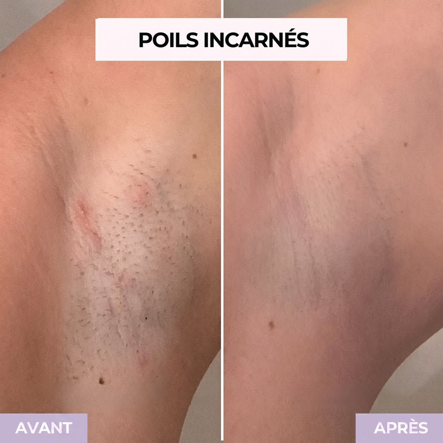 Avis Sovelya 1