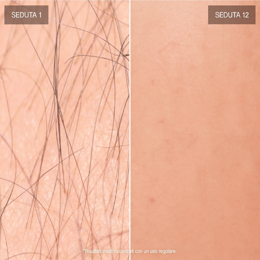 Seduta 8 a 12+