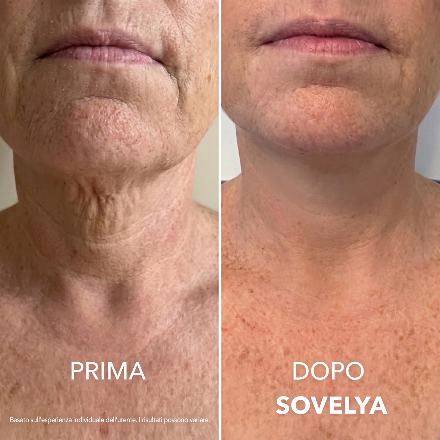 Crema Collo Rassodante e Liftante