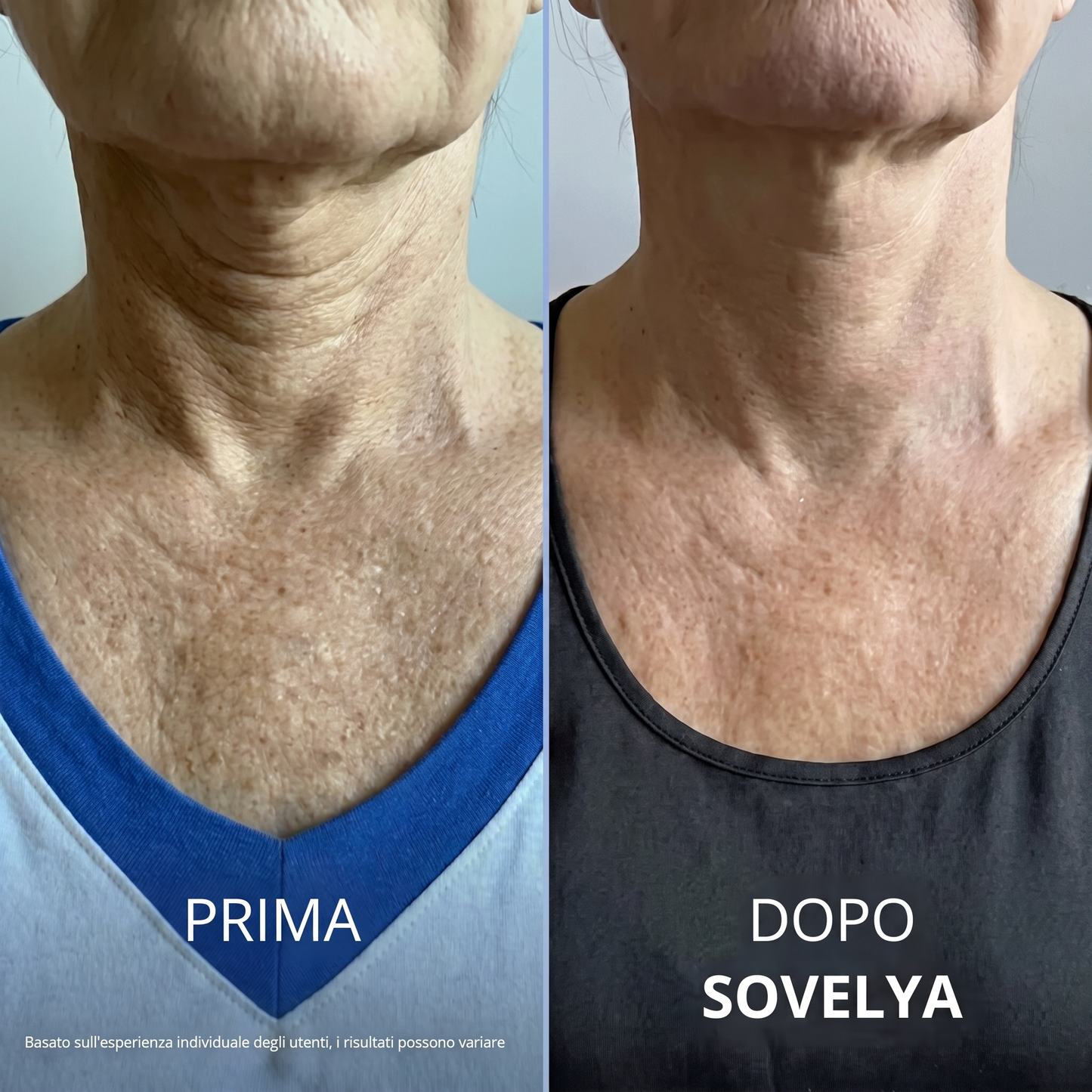 Crema Collo Rassodante e Liftante