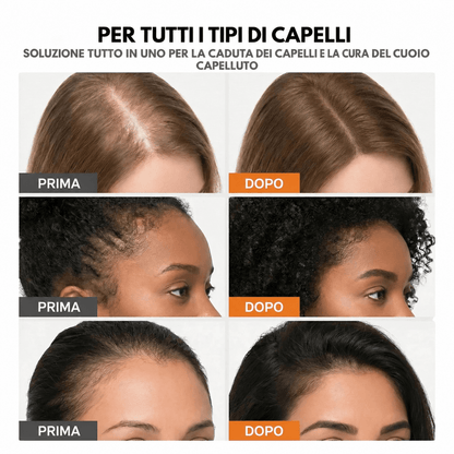 Sovelya™ Fermati la Caduta. Fai Ricrescere i Tuoi Capelli