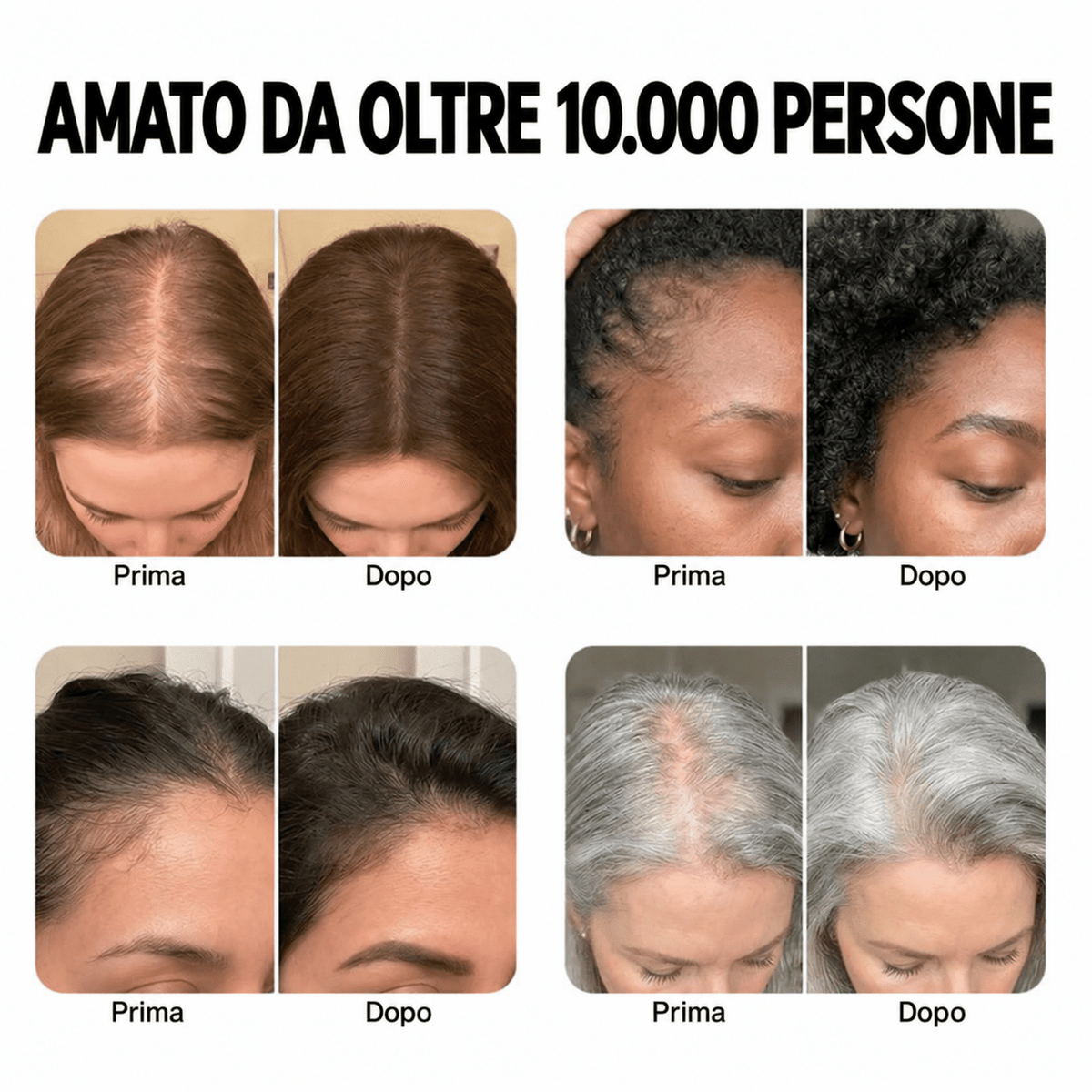 Sovelya™ Fermati la Caduta. Fai Ricrescere i Tuoi Capelli